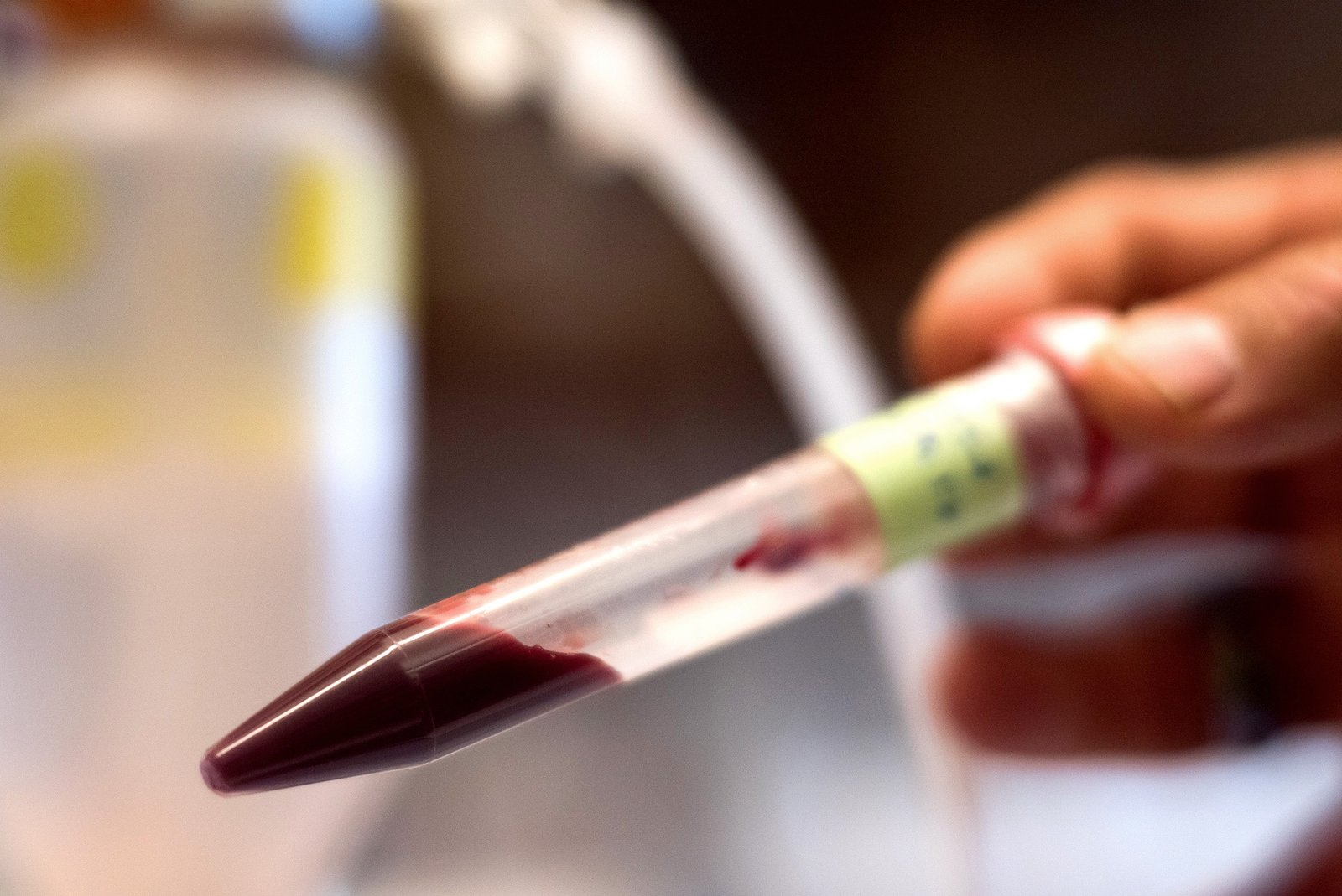 The artificial blood could be freezedried into a powder and then mixed with sterile water when needed.